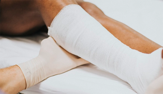 Acute pain is intense, sharp, short-term pain that comes on suddenly