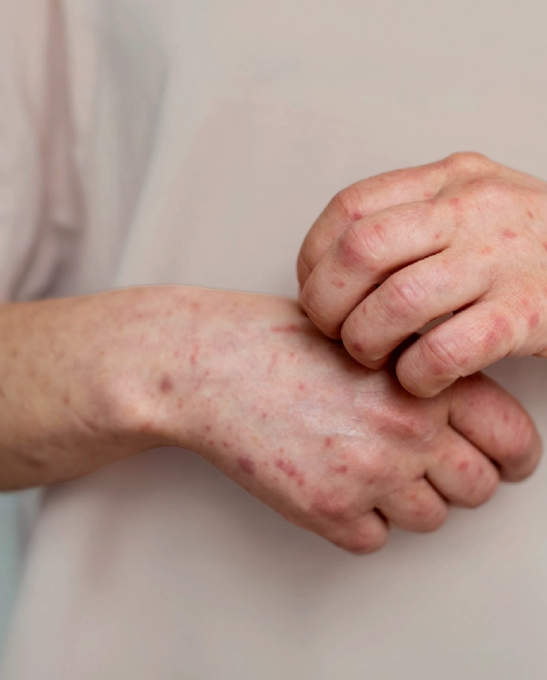 View our symptom checker for Sinusitis & Allergies