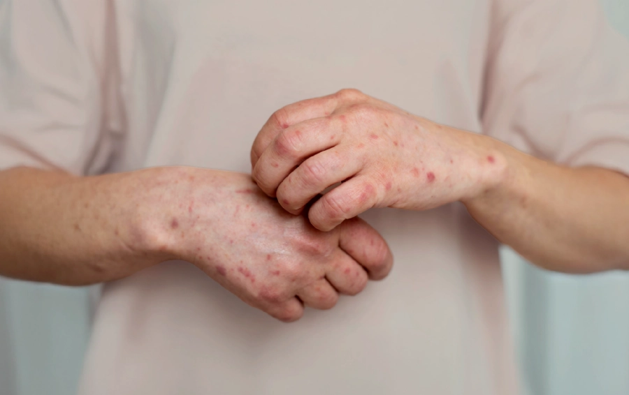 View our symptom checker for Sinusitis & Allergies